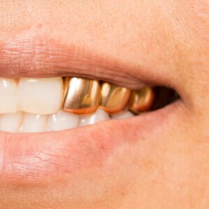 Solid 3pc gold grill